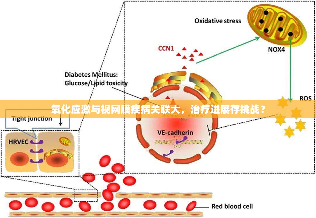 氧化应激与视网膜疾病关联大，治疗进展存挑战？