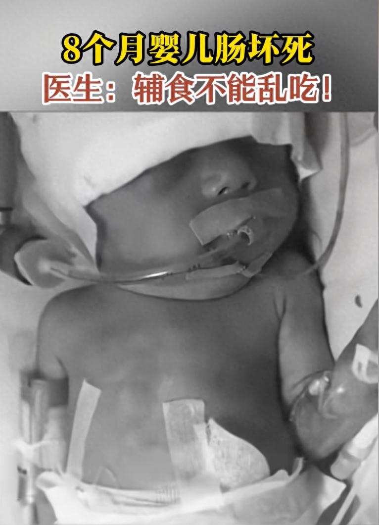 _肠坏死能活多久_新生儿为什么会肠坏死