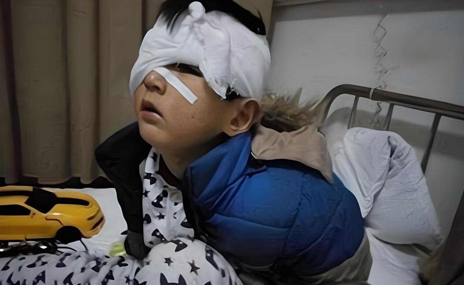 _眼睛被喷了清洁剂怎么办_眼睛不小心喷到药水怎么办